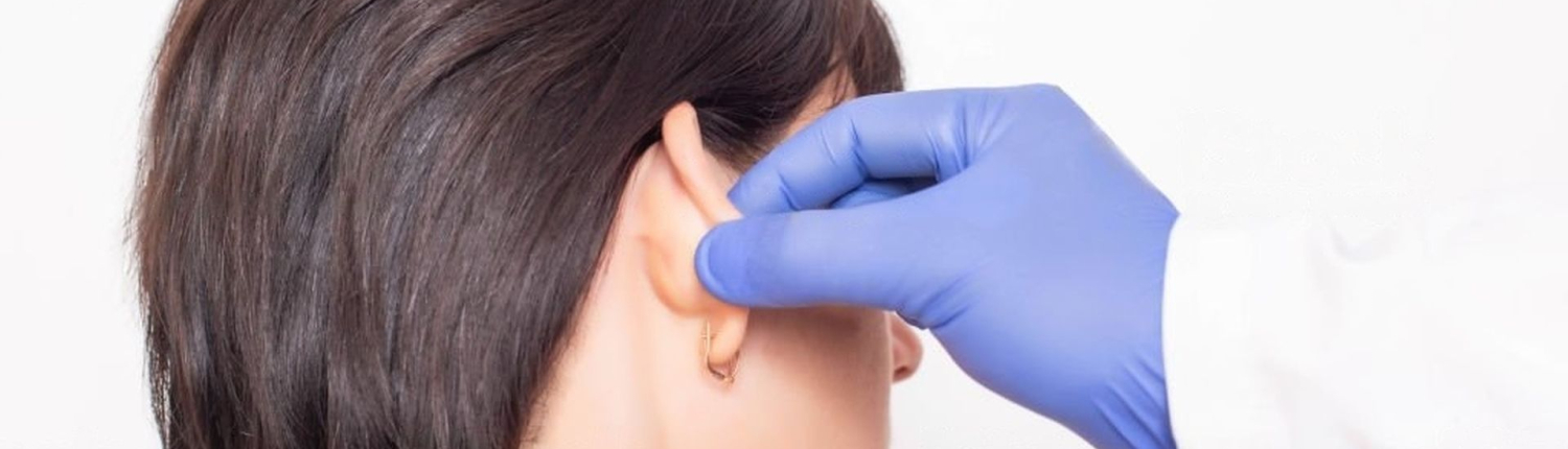 correction des oreilles décollées - Dr Paul Seknadje, chirurgien esthétique à Paris
