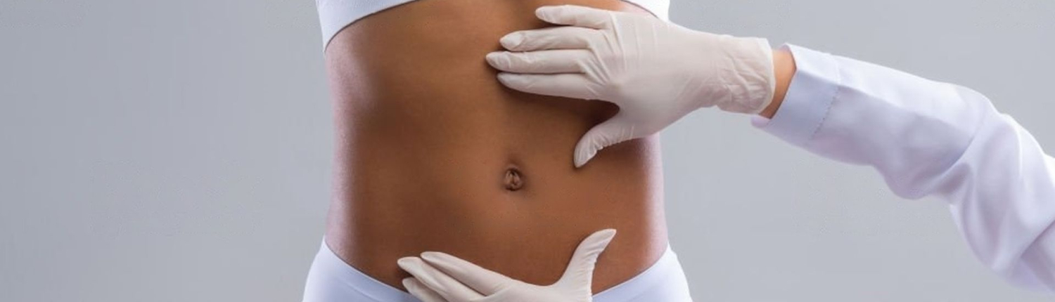 Lifting abdominal complet lifting abdominal complet - Dr Paul Seknadje, chirurgien esthetique a Paris (photo 1)