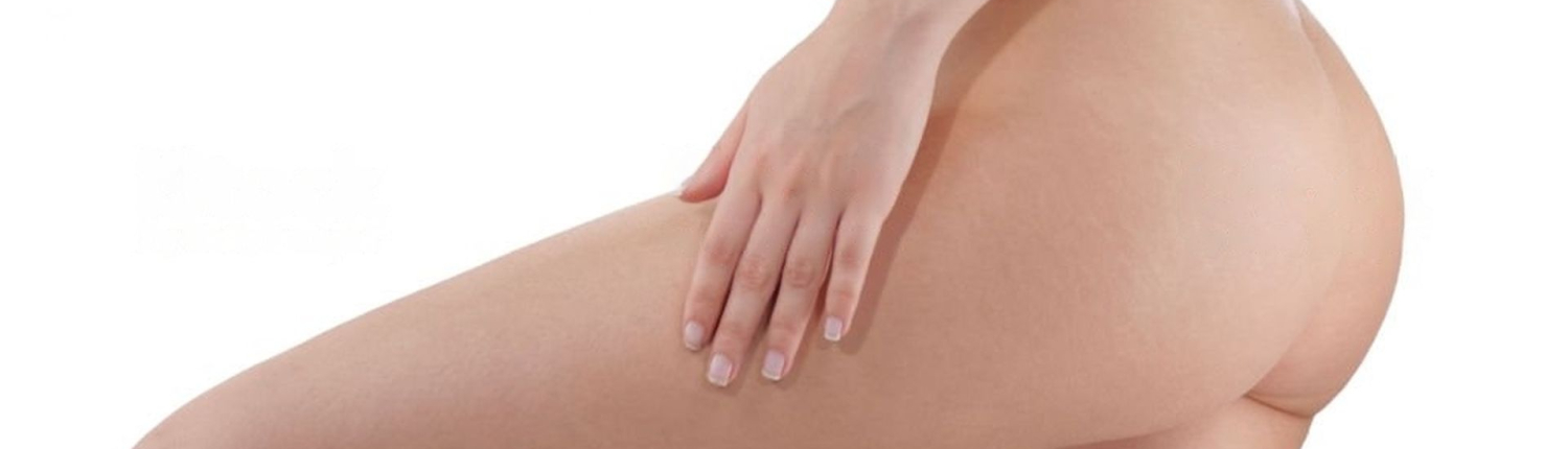 liposuccion - Dr Paul Seknadje, chirurgien esthétique à Paris