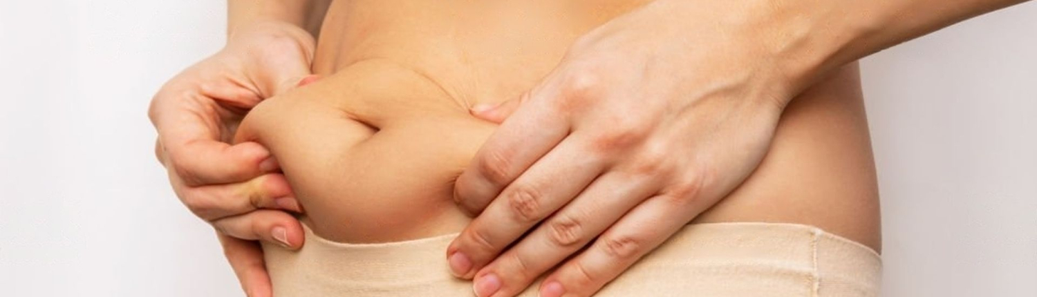 Mini plastie abdominale mini plastie abdominale - Dr Paul Seknadje, chirurgien esthétique à Paris