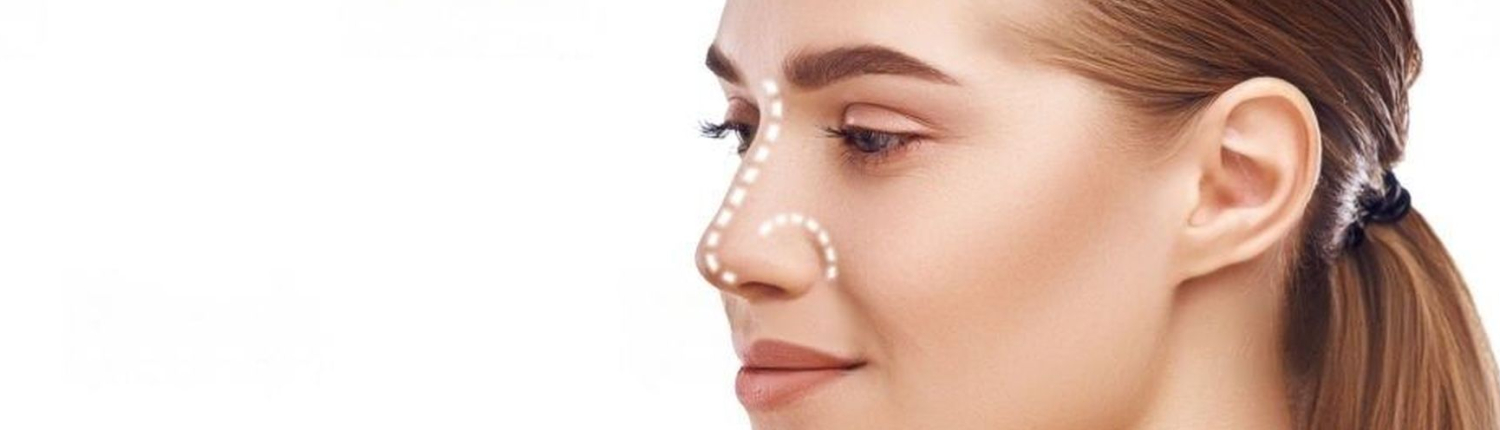 Rhinoplastie rhinoplastie - Dr Paul Seknadje, chirurgien esthétique à Paris